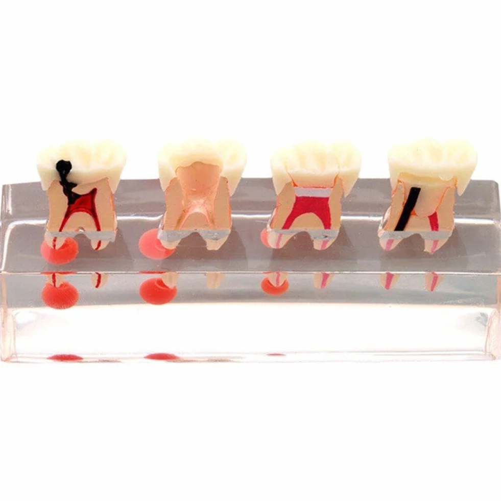 Przezroczysty model zębów dentystycznych do leczenia endodontycznego demonstruje model nauczania stomatologicznego